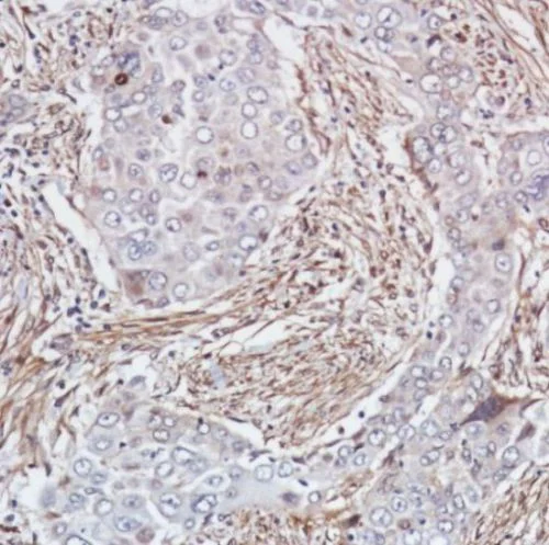 Immunohistochemistry (Formalin/PFA-fixed paraffin-embedded sections) - Anti-Smad4 antibody [SP306] - C-terminal, prediluted (AB228205)