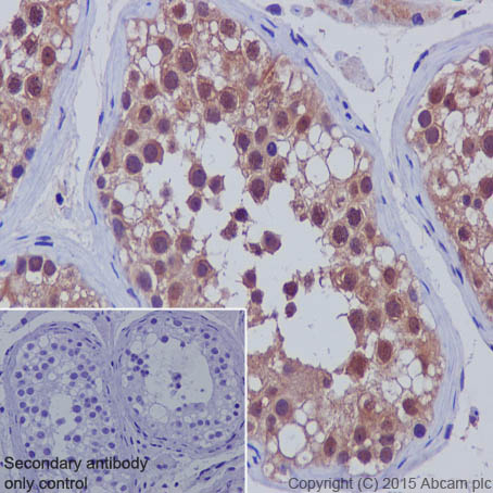 Immunohistochemistry (Formalin/PFA-fixed paraffin-embedded sections) - Anti-SMAD5 antibody [EP619Y] (ab40771), expandable thumbnail