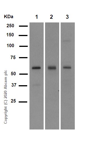 Western blot - Anti-SMAD5 antibody [EP619Y] (AB40771), expandable thumbnail