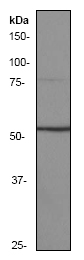 Western blot - Anti-SMAD5 antibody [EP619Y] (ab40771), expandable thumbnail