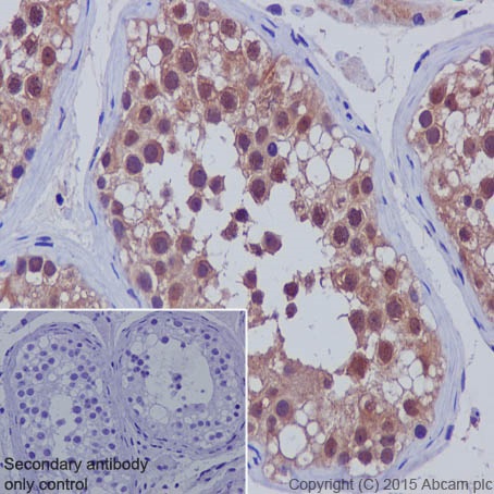 Immunohistochemistry (Formalin/PFA-fixed paraffin-embedded sections) - Anti-SMAD5 antibody [EP619Y] - BSA and Azide free (AB238952), expandable thumbnail