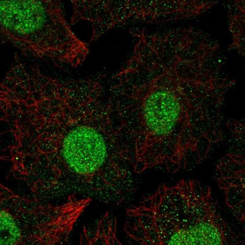 Immunocytochemistry/ Immunofluorescence - Anti-SMAD6 antibody (AB244521)