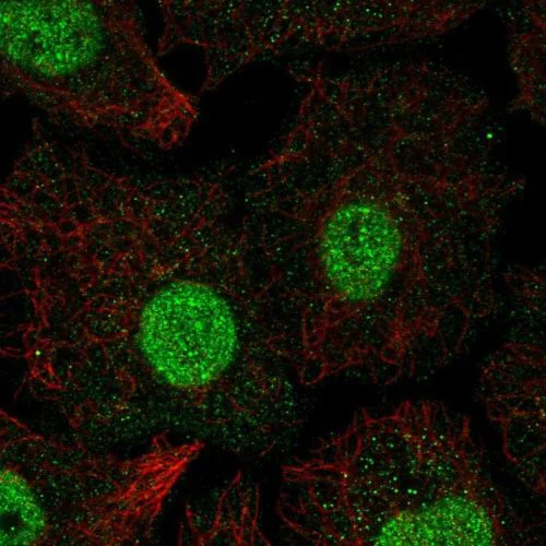 Immunocytochemistry/ Immunofluorescence - Anti-SMAD6 antibody (AB244521)
