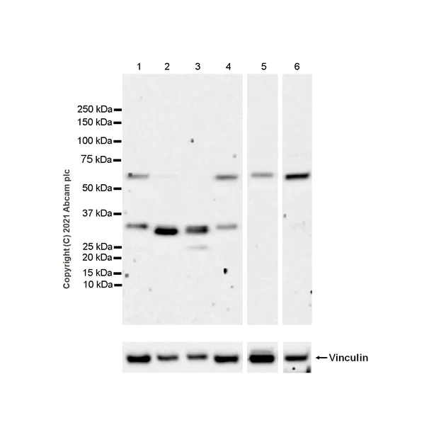 Western blot - Anti-SMAD6 antibody [EPR24687-21] - BSA and Azide free (AB283282)