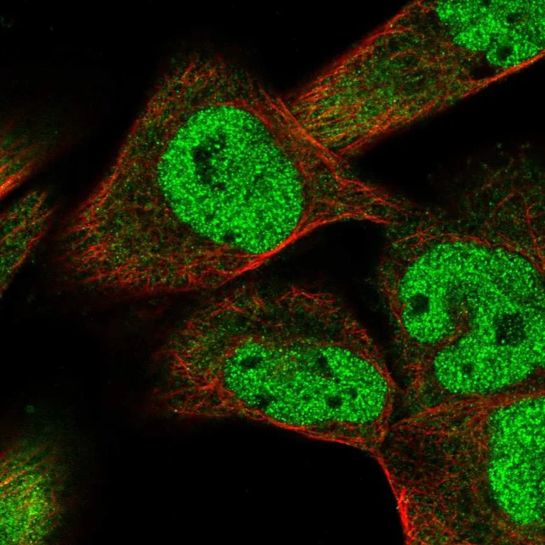 Immunocytochemistry/ Immunofluorescence - Anti-SMAD9 antibody (AB262940)