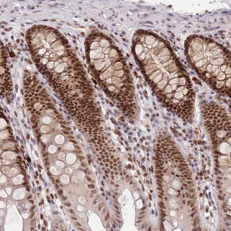 Immunohistochemistry (Formalin/PFA-fixed paraffin-embedded sections) - Anti-SMAD9 antibody (AB262940)