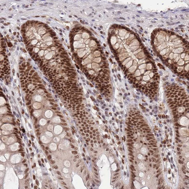 Immunohistochemistry (Formalin/PFA-fixed paraffin-embedded sections) - Anti-SMAD9 antibody (AB262940)