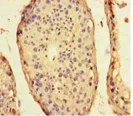 Immunohistochemistry (Formalin/PFA-fixed paraffin-embedded sections) - Anti-Small integral membrane protein 1 antibody (AB234743)
