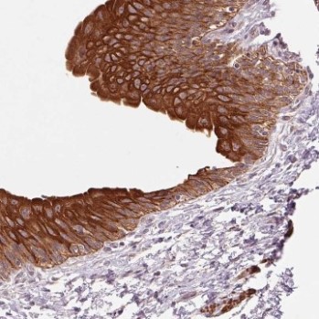 Immunohistochemistry (Formalin/PFA-fixed paraffin-embedded sections) - Anti-Small leucine rich protein 1 antibody (AB204982)