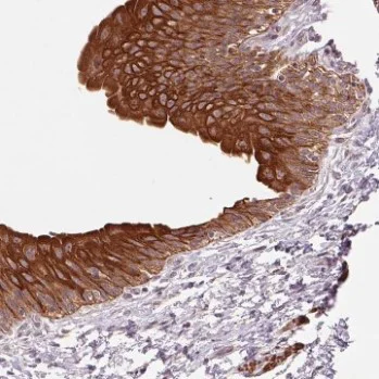 Immunohistochemistry (Formalin/PFA-fixed paraffin-embedded sections) - Anti-Small leucine rich protein 1 antibody (AB204982)