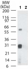 Western blot - Anti-Smallpox B5R antibody (AB53309)