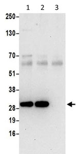Immunoprecipitation - Anti-SMAP antibody (AB202282)