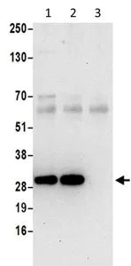 Immunoprecipitation - Anti-SMAP antibody (AB202282)