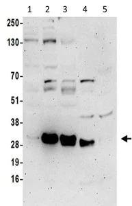 Western blot - Anti-SMAP antibody (AB202282)