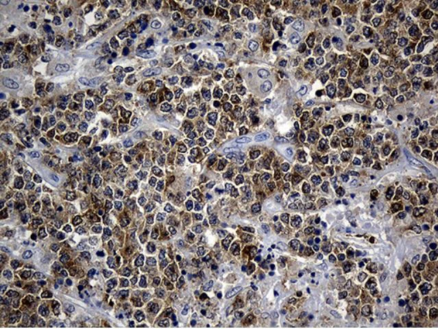 Immunohistochemistry (Formalin/PFA-fixed paraffin-embedded sections) - Anti-SMAP2 antibody [OTI9B6] (AB279386)