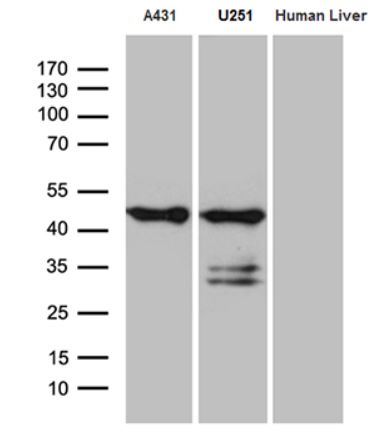 Western blot - Anti-SMAP2 antibody [OTI9B6] (AB279386), expandable thumbnail