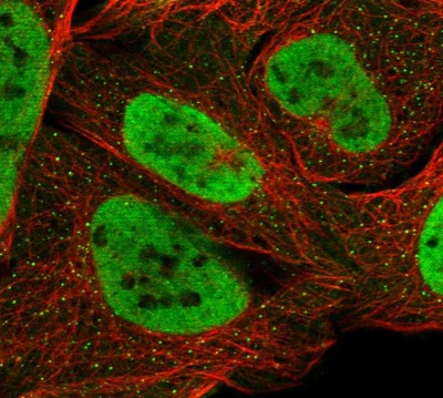 Immunocytochemistry/ Immunofluorescence - Anti-SMARCA2 / BRM antibody (AB223735)