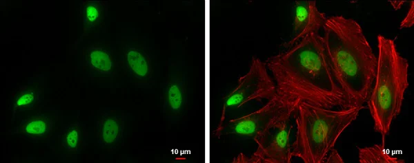 Immunocytochemistry/ Immunofluorescence - Anti-SMARCA2 / BRM antibody (AB227000)
