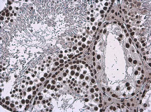 Immunohistochemistry (Formalin/PFA-fixed paraffin-embedded sections) - Anti-SMARCA2 / BRM antibody (AB227000)