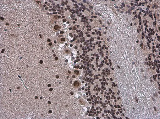 Immunohistochemistry (Formalin/PFA-fixed paraffin-embedded sections) - Anti-SMARCA2 / BRM antibody (AB227000)
