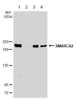 Western blot - Anti-SMARCA2 / BRM antibody (AB227000)