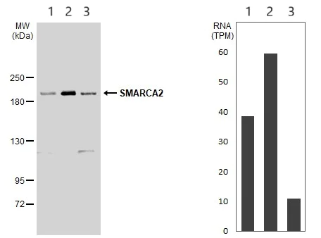 Western blot - Anti-SMARCA2 / BRM antibody (AB227000)