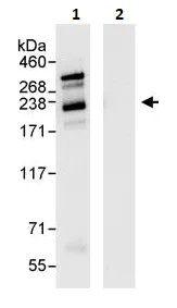 Immunoprecipitation - Anti-SMARCA2 / BRM antibody (AB264163)