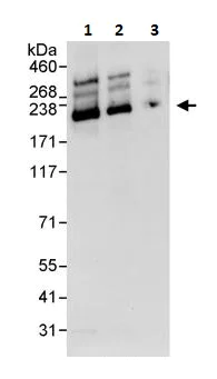 Western blot - Anti-SMARCA2 / BRM antibody (AB264163)