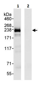 Immunoprecipitation - Anti-SMARCA2 / BRM antibody (AB264164)