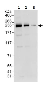 Western blot - Anti-SMARCA2 / BRM antibody (AB264164)