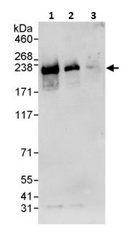 Western blot - Anti-SMARCA2 / BRM antibody (AB264165)