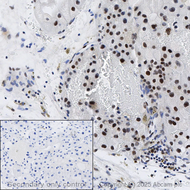 Immunohistochemistry (Formalin/PFA-fixed paraffin-embedded sections) - Anti-SMARCA2 / BRM antibody [EPR23103-44] (AB240648)