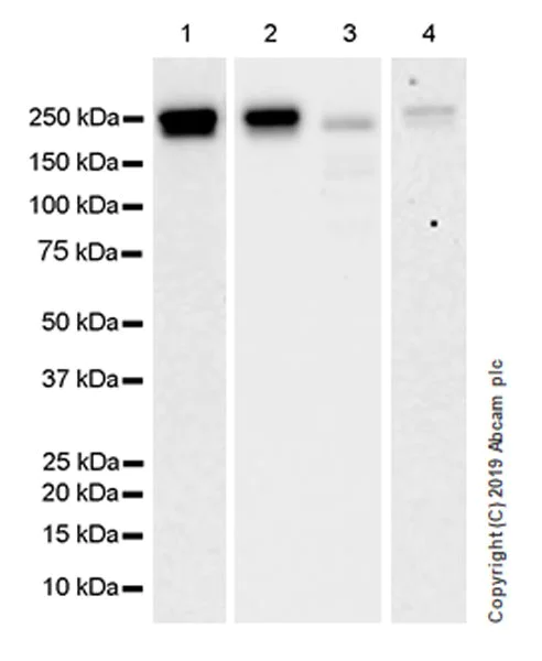Western blot - Anti-SMARCA2 / BRM antibody [EPR23103-44] (AB240648)
