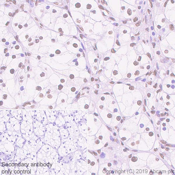 Immunohistochemistry (Formalin/PFA-fixed paraffin-embedded sections) - Anti-SMARCA2 / BRM antibody [EPR23103-44] - BSA and Azide free (AB269872), expandable thumbnail
