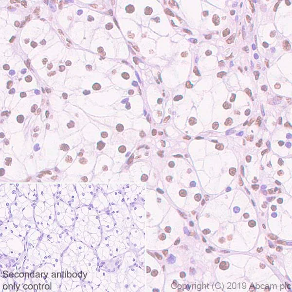Immunohistochemistry (Formalin/PFA-fixed paraffin-embedded sections) - Anti-SMARCA2 / BRM antibody [EPR23103-44] - BSA and Azide free (AB269872)