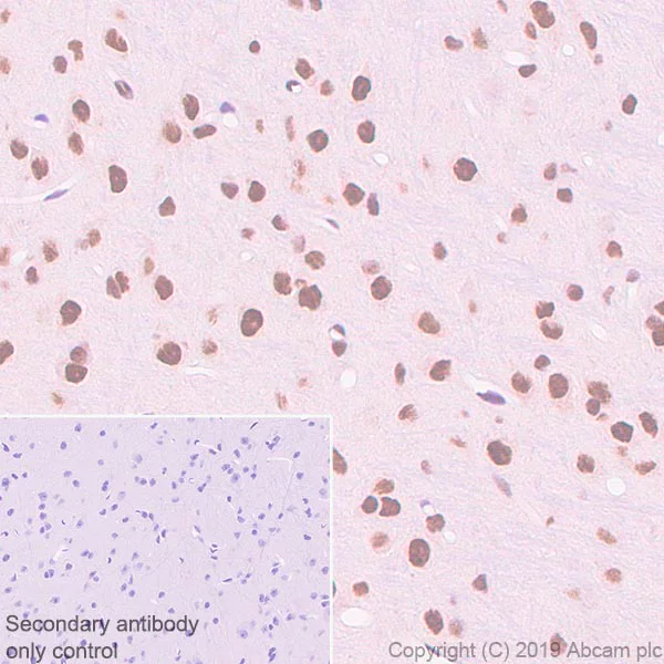 Immunohistochemistry (Formalin/PFA-fixed paraffin-embedded sections) - Anti-SMARCA2 / BRM antibody [EPR23103-44] - BSA and Azide free (AB269872)