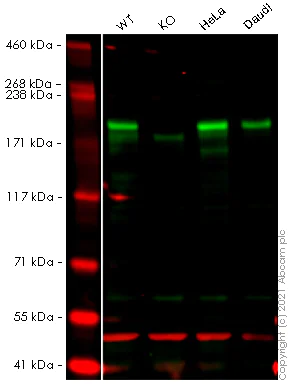 Western blot - Anti-SMARCA2 / BRM antibody [EPR23103-44] - BSA and Azide free (AB269872)