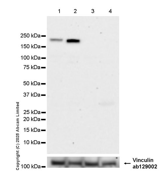 Western blot - Anti-SMARCA2 / BRM antibody [EPR28611-92] (AB323179), expandable thumbnail
