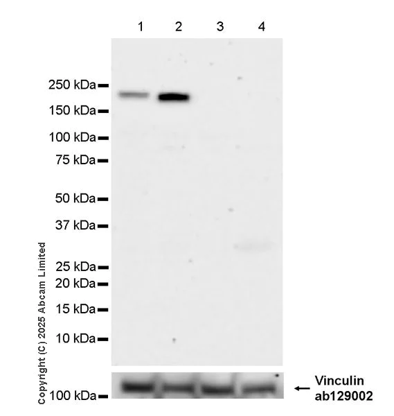 Western blot - Anti-SMARCA2 / BRM antibody [EPR28611-92] (AB323179)