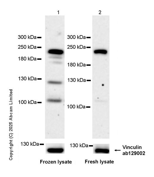 Western blot - Anti-SMARCA2 / BRM antibody [EPR28611-92] (AB323179), expandable thumbnail
