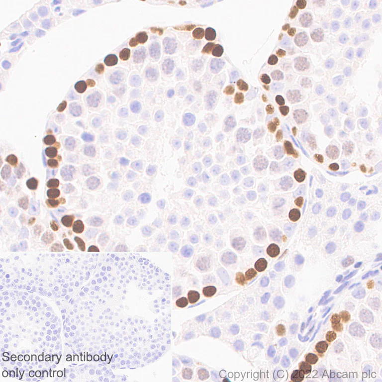 Immunohistochemistry (Formalin/PFA-fixed paraffin-embedded sections) - Anti-SMARCA6 antibody [EPR25295-62] (AB300040)