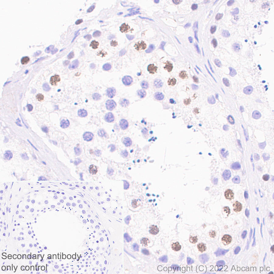 Immunohistochemistry (Formalin/PFA-fixed paraffin-embedded sections) - Anti-SMARCA6 antibody [EPR25295-62] (AB300040)