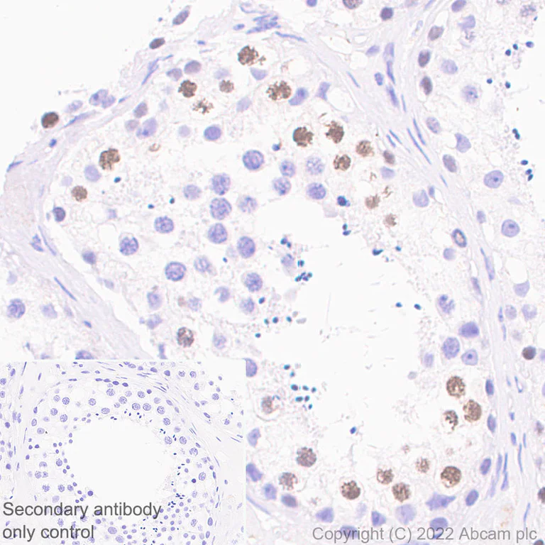 Immunohistochemistry (Formalin/PFA-fixed paraffin-embedded sections) - Anti-SMARCA6 antibody [EPR25295-62] (AB300040)
