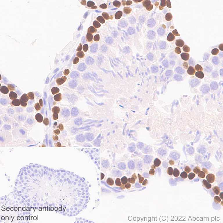 Immunohistochemistry (Formalin/PFA-fixed paraffin-embedded sections) - Anti-SMARCA6 antibody [EPR25295-62] (BSA and Azide free) (AB300041)