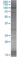 SDS-PAGE - SMARCA6 overexpression 293T lysate (whole cell) (AB94327), expandable thumbnail