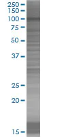 SDS-PAGE - SMARCA6 overexpression 293T lysate (whole cell) (AB94327)
