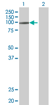 Western blot - SMARCA6 overexpression 293T lysate (whole cell) (AB94327), expandable thumbnail