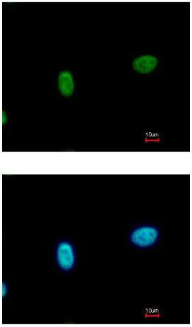 Immunocytochemistry/ Immunofluorescence - Anti-SmarcAL1 antibody (AB154226)