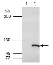 Immunoprecipitation - Anti-SmarcAL1 antibody (AB154226)