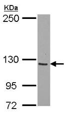 Western blot - Anti-SmarcAL1 antibody (AB154226), expandable thumbnail